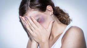 Mutilated women cover her bruised face with shame