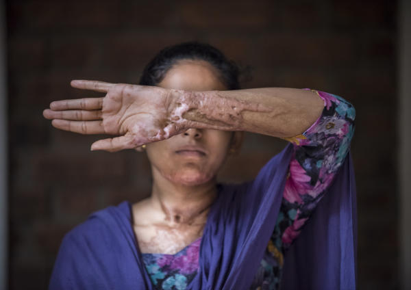 Christian Jaeggi fotografierte im indischen Bangalore Frauen, die Opfer von häuslicher Gewalt wurden.