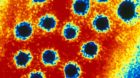 Hepatitis: Gratis-Bluttests für alle sollen helfen, dass die Viren früher erkannt werden. 