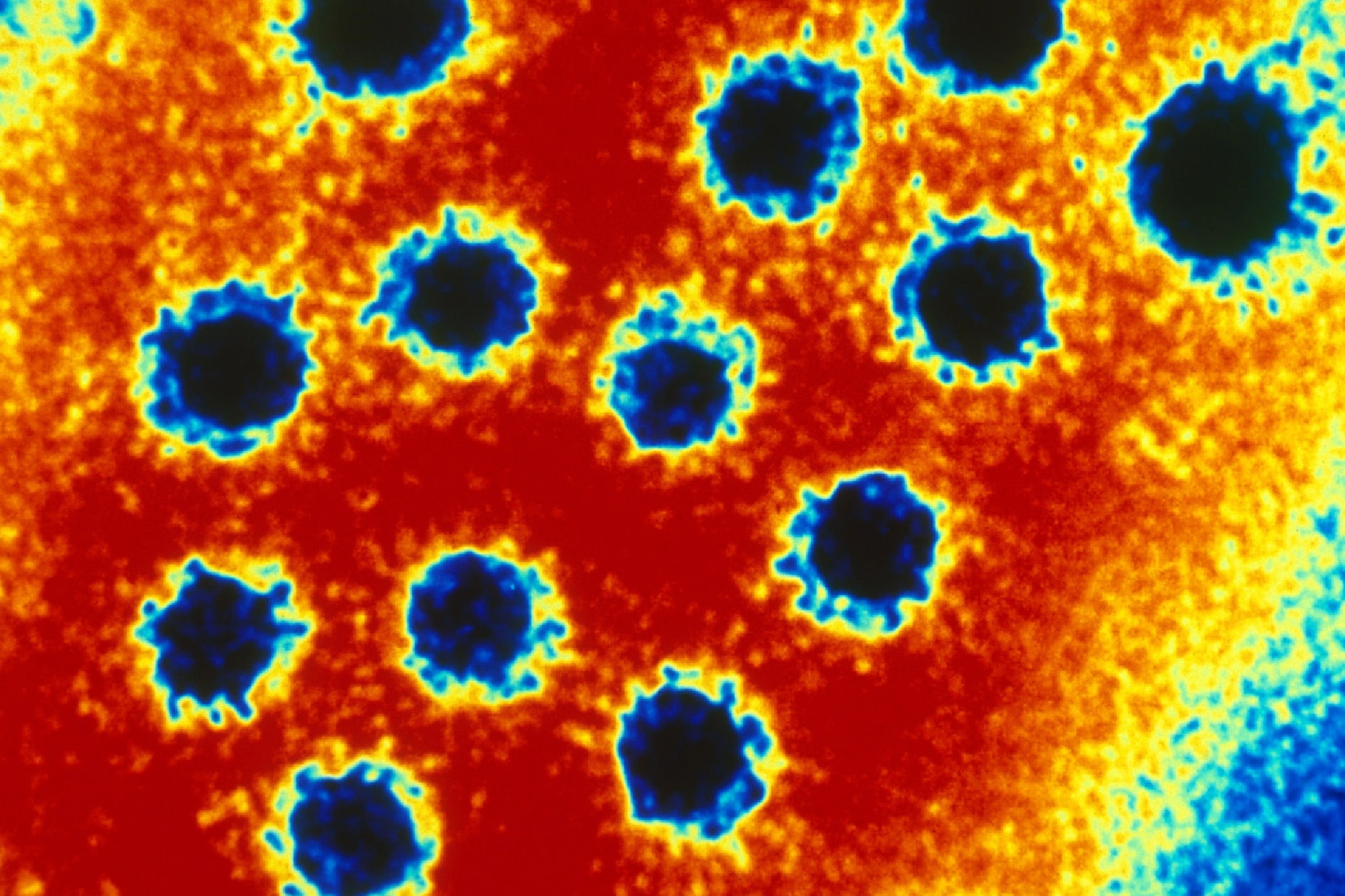 Neuer Hepatitis C Test Fur Alle Ist Teuer Tageswoche